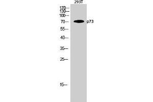 Western Blot (WB) analysis of 293T cells using p73 Polyclonal Antibody. (Tumor Protein p73 Antikörper  (Tyr220))