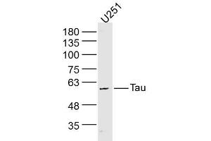 U251 lysates probed with Tau Polyclonal Antibody, Unconjugated  at 1:300 dilution and 4˚C overnight incubation. (tau Antikörper)