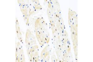 Immunohistochemistry of paraffin-embedded rat heart using TAF9 antibody (ABIN5971055) at dilution of 1/100 (40x lens). (TAF9 Antikörper)