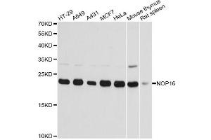 Western blot analysis of extracts of various cell lines, using NOP16 antibody (ABIN6293674) at 1:3000 dilution. (NOP16 Antikörper)