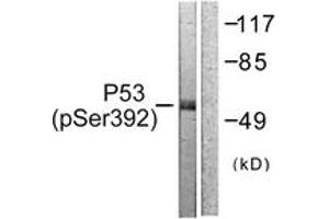 Western blot analysis of extracts from 293 cells treated with Etoposide 25uM 60', using p53 (Phospho-Ser392) Antibody. (p53 Antikörper  (pSer392))