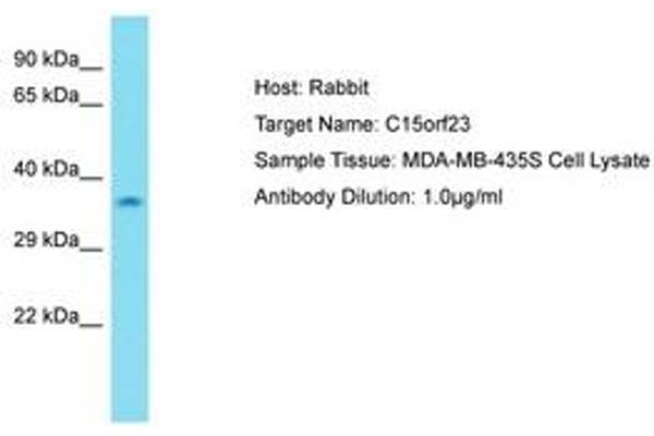 KNSTRN Antikörper  (AA 31-80)