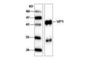 Image no. 1 for anti-Hepatitis A Virus VP1 (HAV VP1) (AA 7-143) antibody (ABIN791617) (HAV VP1 Antikörper  (AA 7-143))