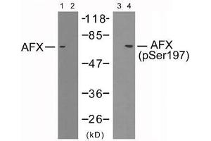 Western blot analysis of extracts from 293 cells using AFX (Ab-197) antibody (E021162, Lane 1 and 2) and AFX (phospho-Ser197) antibody (E011137, Lane 3 and 4). (FOXO4 Antikörper)