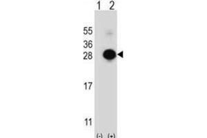 Western Blotting (WB) image for anti-MOB1, Mps One Binder Kinase Activator-Like 1B (MOBKL1B) antibody (ABIN3003175) (MOB1A Antikörper)