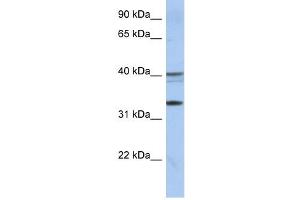 TEX264 antibody used at 1 ug/ml to detect target protein. (TEX264 Antikörper  (Middle Region))