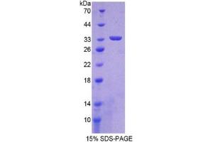 SDS-PAGE (SDS) image for Hypoxia Inducible Factor 1, alpha Subunit (Basic Helix-Loop-Helix Transcription Factor) (HIF1A) ELISA Kit (ABIN6574209)