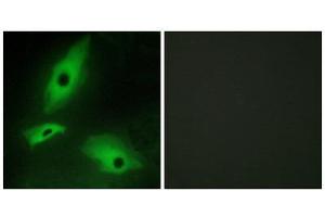 Immunofluorescence (IF) image for anti-Lymphotoxin beta Receptor (TNFR Superfamily, Member 3) (LTBR) (N-Term) antibody (ABIN1849343) (LTBR Antikörper  (N-Term))