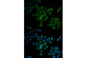 Immunofluorescence analysis of A549 cells using CASP9 antibody. (Caspase 9 Antikörper)