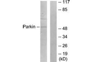 Western blot analysis of extracts from Jurkat cells, using Parkin Antibody. (Parkin Antikörper  (AA 1-50))