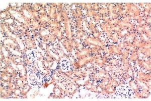 Immunohistochemistry of paraffin-embedded Mouse kidney tissue using Bax Monoclonal Antibody at dilution of 1:200. (BAX Antikörper)