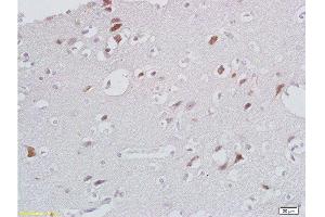 Formalin-fixed and paraffin embedded human brain labeled with Anti- CXCL13/BCA1 Polyclonal Antibody, Unconjugated  at 1:200 followed by conjugation to the secondary antibody and DAB (CXCL13 Antikörper  (AA 23-109))