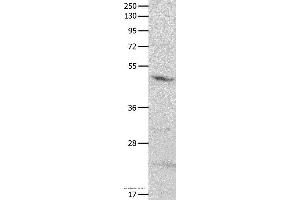 Western blot analysis of Mouse brain tissue, using GNAS Polyclonal Antibody at dilution of 1:500 (GNAS Antikörper)