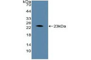 Detection of Recombinant ARNT, Human using Polyclonal Antibody to Aryl Hydrocarbon Receptor Nuclear Translocator (ARNT) (ARNT Antikörper  (AA 624-789))