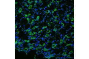 Aquaporin 1 Immunofluorescence. (Aquaporin 1 Antikörper  (N-Term))