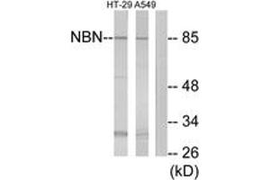 Western Blotting (WB) image for anti-Nibrin (NBN) (AA 431-480) antibody (ABIN2890017) (Nibrin Antikörper  (AA 431-480))