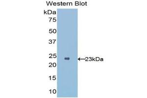 Detection of Recombinant IL1RL1, Human using Polyclonal Antibody to Interleukin 1 Receptor Like Protein 1 (IL1RL1) (IL1RL1 Antikörper  (AA 162-349))