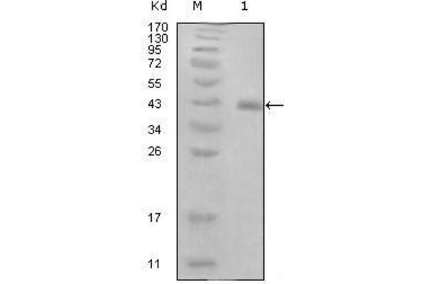 HPV16 E7 Antikörper