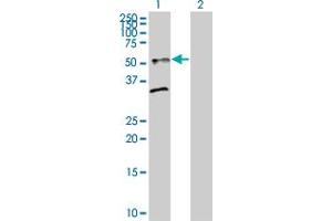 Western Blotting (WB) image for ST8SIA2 293T Cell Transient Overexpression Lysate(Denatured) (ABIN1334054)