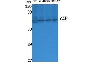 Western Blot (WB) analysis of specific cells using YAP Polyclonal Antibody. (YAP1 Antikörper  (Internal Region))