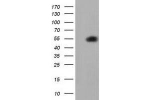 HEK293T cells were transfected with the pCMV6-ENTRY control (Left lane) or pCMV6-ENTRY SMAD2 (Right lane) cDNA for 48 hrs and lysed. (SMAD2 Antikörper)