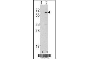 Image no. 1 for anti-tyrosine Kinase, Non-Receptor, 2 (TNK2) (AA 934-964) antibody (ABIN2451837) (TNK2 Antikörper  (AA 934-964))
