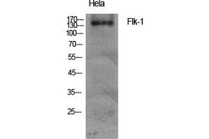 Western Blotting (WB) image for anti-VEGF Receptor 2 (VEGFR2) (Tyr951) antibody (ABIN5961553) (VEGFR2/CD309 Antikörper  (Tyr951))