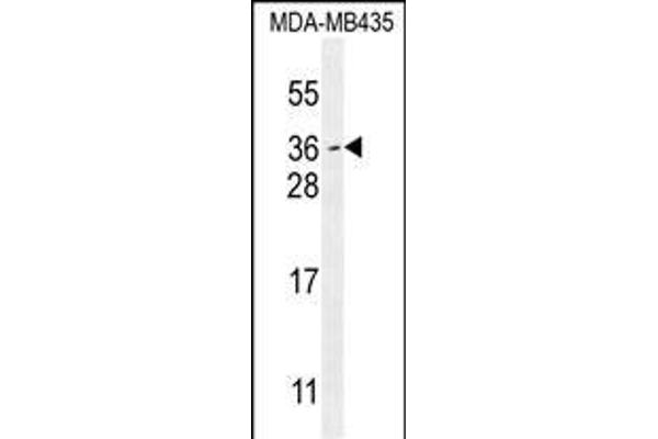 Myc Target 1 Antikörper  (C-Term)