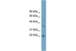 Image no. 1 for anti-Low Density Lipoprotein Receptor Class A Domain Containing 1 (LDLRAD1) (AA 107-156) antibody (ABIN6743318) (LDLRAD1 Antikörper  (AA 107-156))