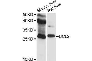 Western blot analysis of extracts of various cell lines, using BCL2 antibody (ABIN5970041) at 1/500 dilution. (Bcl-2 Antikörper)