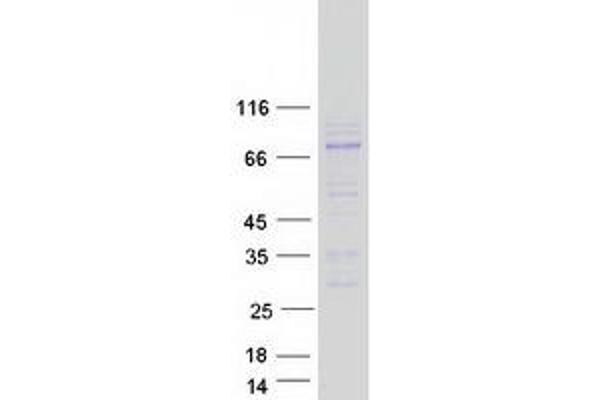 ADAM11 Protein (Myc-DYKDDDDK Tag)