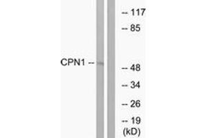 Western Blotting (WB) image for anti-Carboxypeptidase N Subunit 1 (CPN1) (AA 409-458) antibody (ABIN2890195) (CPN1 Antikörper  (AA 409-458))