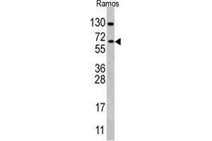 Western blot analysis of anti-CDC25B Antibody (Center) in Ramos cell line lysates (35 µg/lane). (CDC25B Antikörper  (Center))