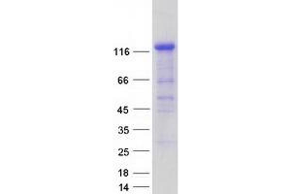 IB2 Protein (Transcript Variant 2) (Myc-DYKDDDDK Tag)