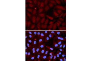 Immunofluorescence analysis of U2OS cell using SFTPC antibody. (Surfactant Protein C Antikörper  (AA 1-197))