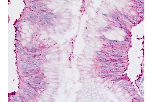 Human Pancreas: Formalin-Fixed, Paraffin-Embedded (FFPE) (Chordin Antikörper  (C-Term))