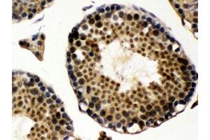 IHC testing of FFPE rat testis with UBE1C antibody. (UBA3 Antikörper)