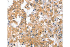 Immunohistochemistry (IHC) image for anti-Cerebellar Degeneration-Related Protein 2, 62kDa (CDR2) antibody (ABIN2423131) (CDR2 Antikörper)