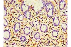 Immunohistochemistry of paraffin-embedded human small intestine tissue using ABIN7168365 at dilution of 1:100 (EWSR1 Antikörper  (AA 1-300))