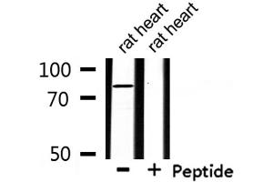 Western blot analysis of extracts from rat heart , using ZFYVE20 Antibody. (Rabenosyn 5 Antikörper  (Internal Region))