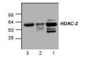 Image no. 1 for anti-Histone Deacetylase 2 (HDAC2) antibody (ABIN127234) (HDAC2 Antikörper)