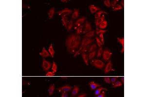 Immunofluorescence analysis of U2OS cells using PAICS Polyclonal Antibody (PAICS Antikörper)