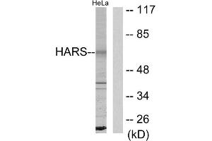 Western blot analysis of extracts from HeLa cells, using HARS antibody. (HARS1/Jo-1 Antikörper  (C-Term))