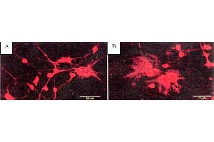 Image no. 1 for anti-BAPTA antibody (ABIN264974) (BAPTA Antikörper)