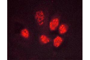 ABIN6267495 staining Hela cells by ICC/IF. (PPARG Antikörper  (pSer112))