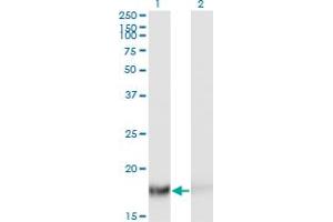 Western Blot analysis of TSC22D1 expression in transfected 293T cell line by TSC22D1 monoclonal antibody (M06), clone 2E2. (TSC22D1 Antikörper  (AA 1-144))