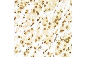 Immunohistochemistry (IHC) image for anti-Lamin A/C (LMNA) (AA 403-572) antibody (ABIN3020785)