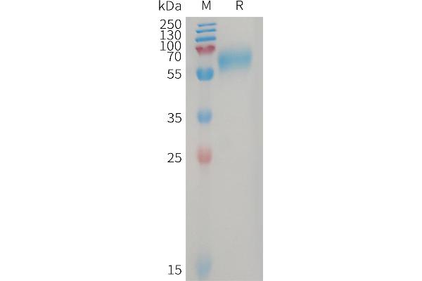 GPR56 Protein (AA 26-402) (His tag)