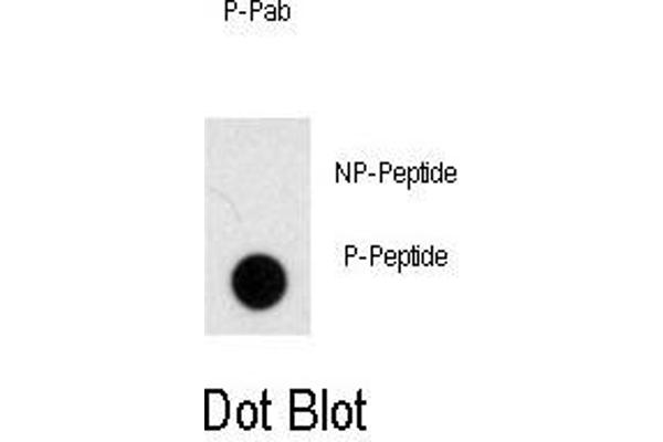 NOMO1 Antikörper  (pSer1205)