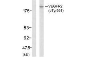Western Blotting (WB) image for anti-VEGF Receptor 2 (VEGFR2) (pTyr951) antibody (ABIN2888557) (VEGFR2/CD309 Antikörper  (pTyr951))